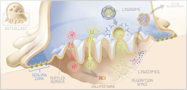 An OnlineMedEd medical illustration