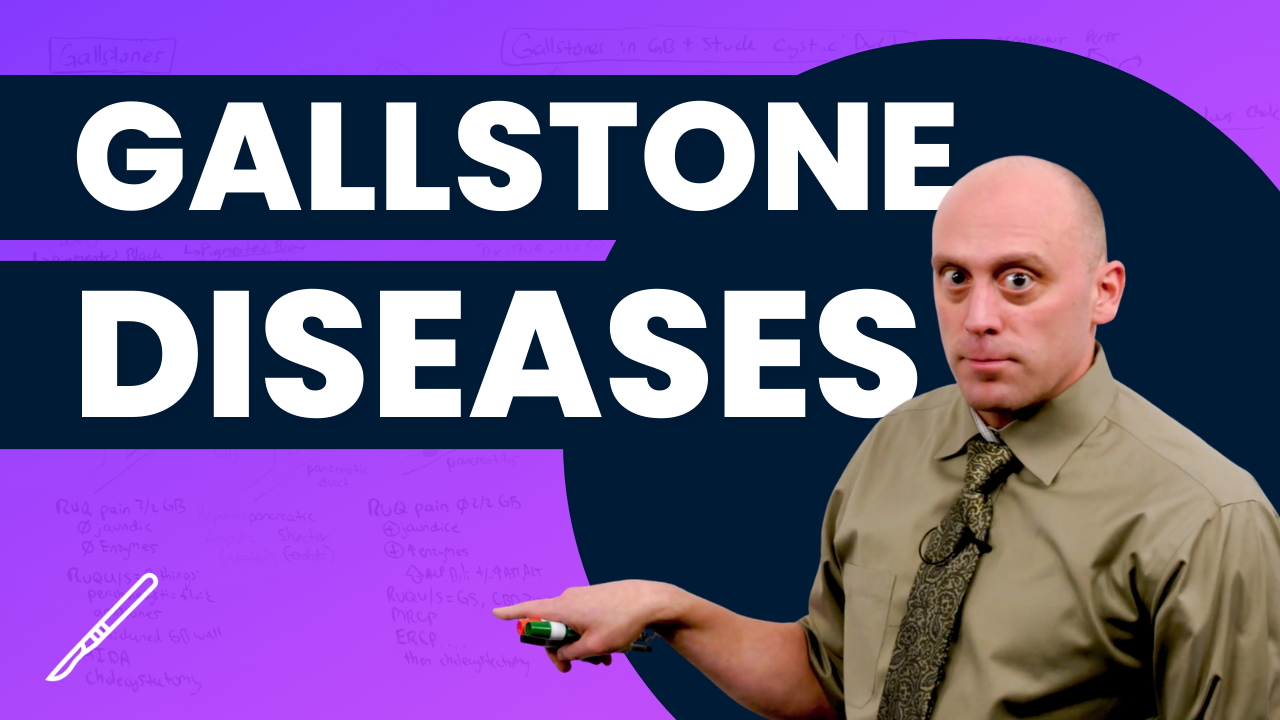 SampleLessonThumbnail_GeneralSurgery_GallstoneDiseases